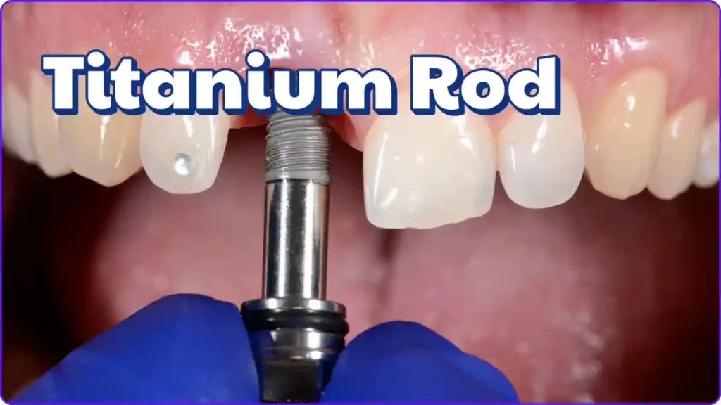Titanium rods